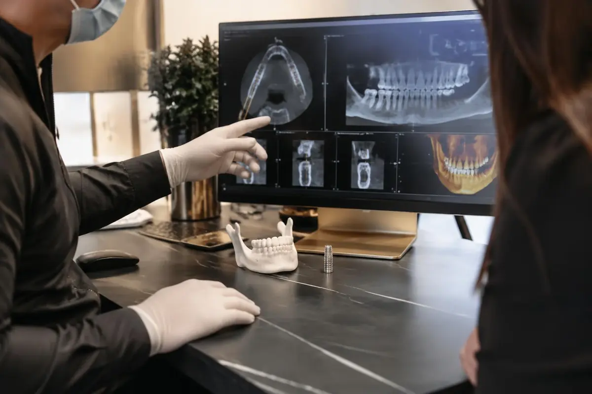 Planejamento de implante dentário com tomografia e modelo odontológico